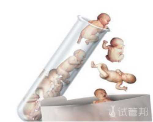 贵阳找代孕做试管婴儿的|舟山三代试管性别鉴定准确吗