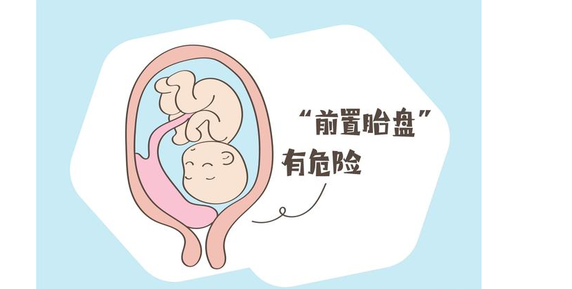 多囊促排怀孕成功率高吗？,代生男宝