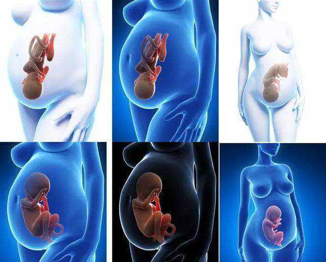 溶血症必须换血吗