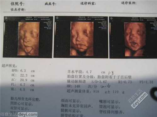 广州代孕生双胞胎_广州哪里有代孕生子的_泰东方国际医疗：服刑期间实施盗窃