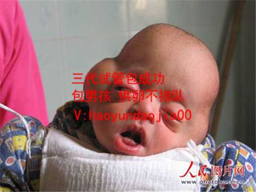 广州供卵网_广州西南医院供卵等多久_[第三代试管婴儿]第三代试管婴儿这项技