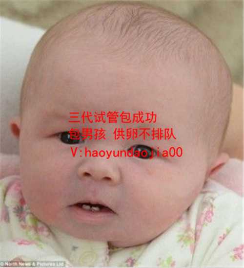 广州供卵生的孩子有血缘_广州世纪助孕供卵试管中心_孕妇脐带血流检查或其他