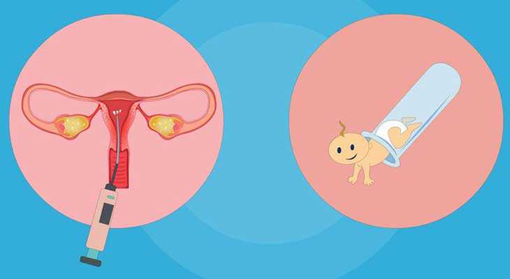 七台河姐妹子宫内膜异位症如何减少手术次数，增加试管婴儿成功率？